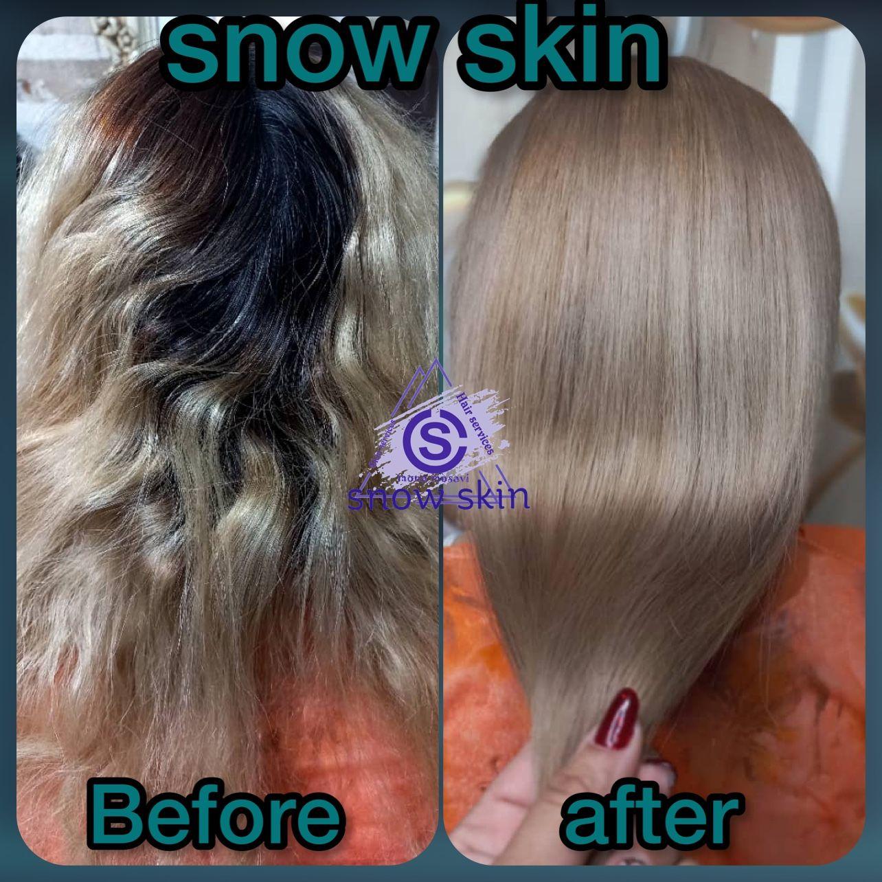 مرکز زیبایی اسنو اسکین