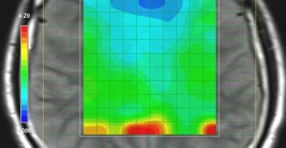 مرکز تصویربرداری توسکا