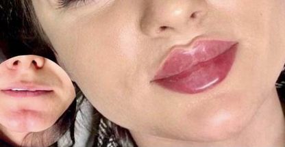 مطب پوست ،مو،زیبایی(دکتر سمیرا گرجی)