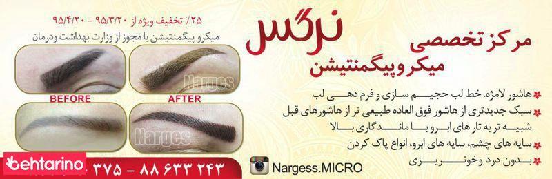 میکروپیگمنتیشن  نرگس
