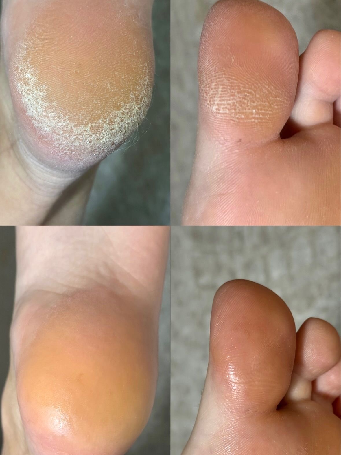 پدیکور و کفسابی پا اذرنوش