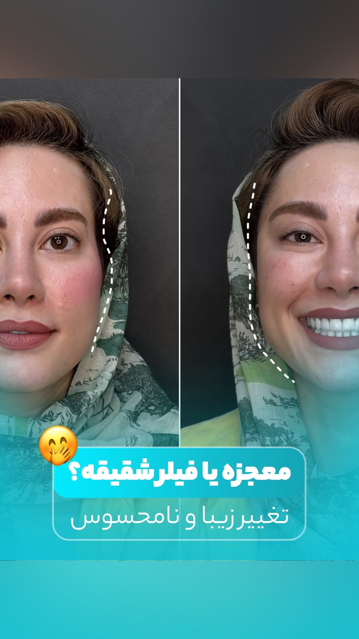 کلینیک زیبایی لیان