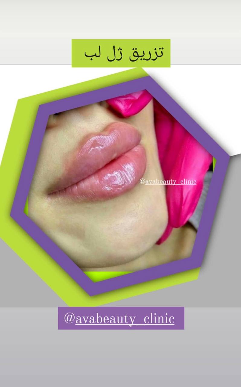 کلینیک زیبایی آوا بیوتی