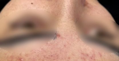 کلینیک تخصصی فیشال و درمان پوست ساقی