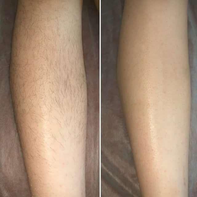 کلینیک لیزر نور