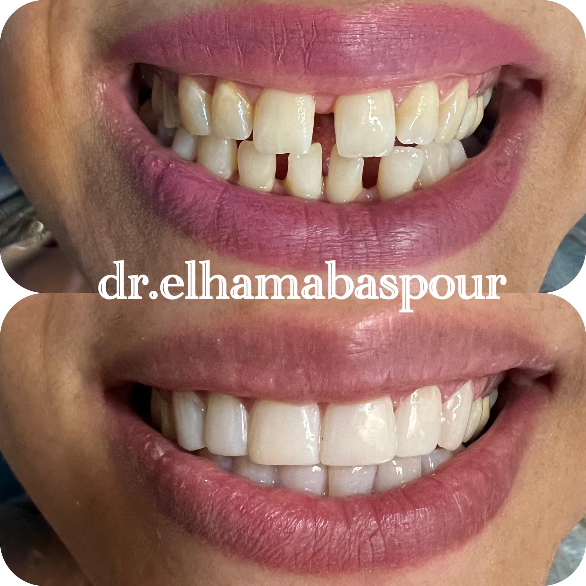 دندانپزشکی و زیبایی دکتر الهام عباسپور