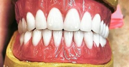 دندانسازی مروارید