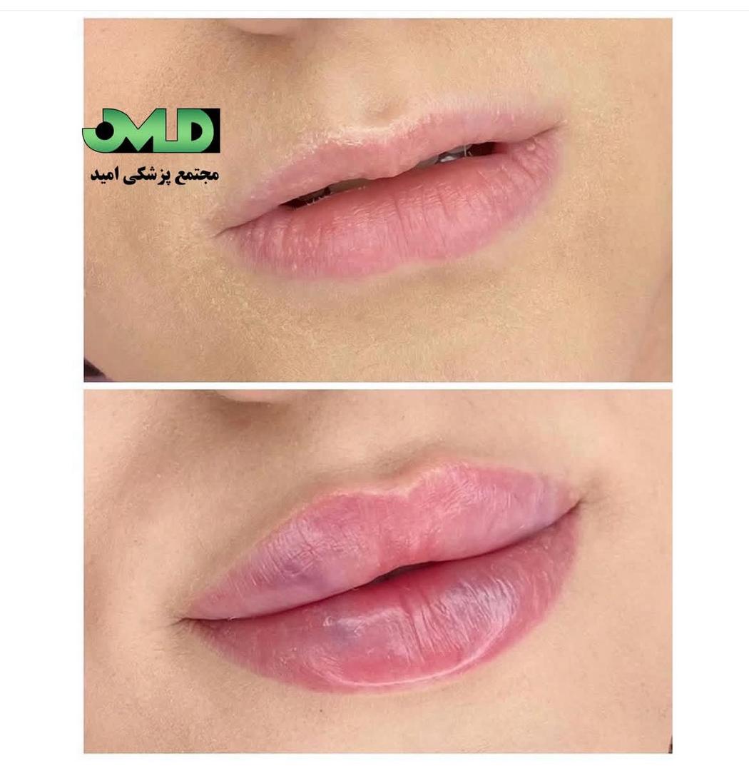 مرکز لیزر و کلینیک زیبایی امید