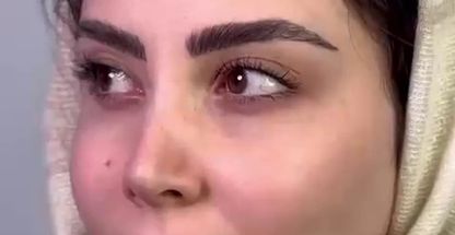 مطب پوست و زیبایی و لیزر دکتر حکیم پور