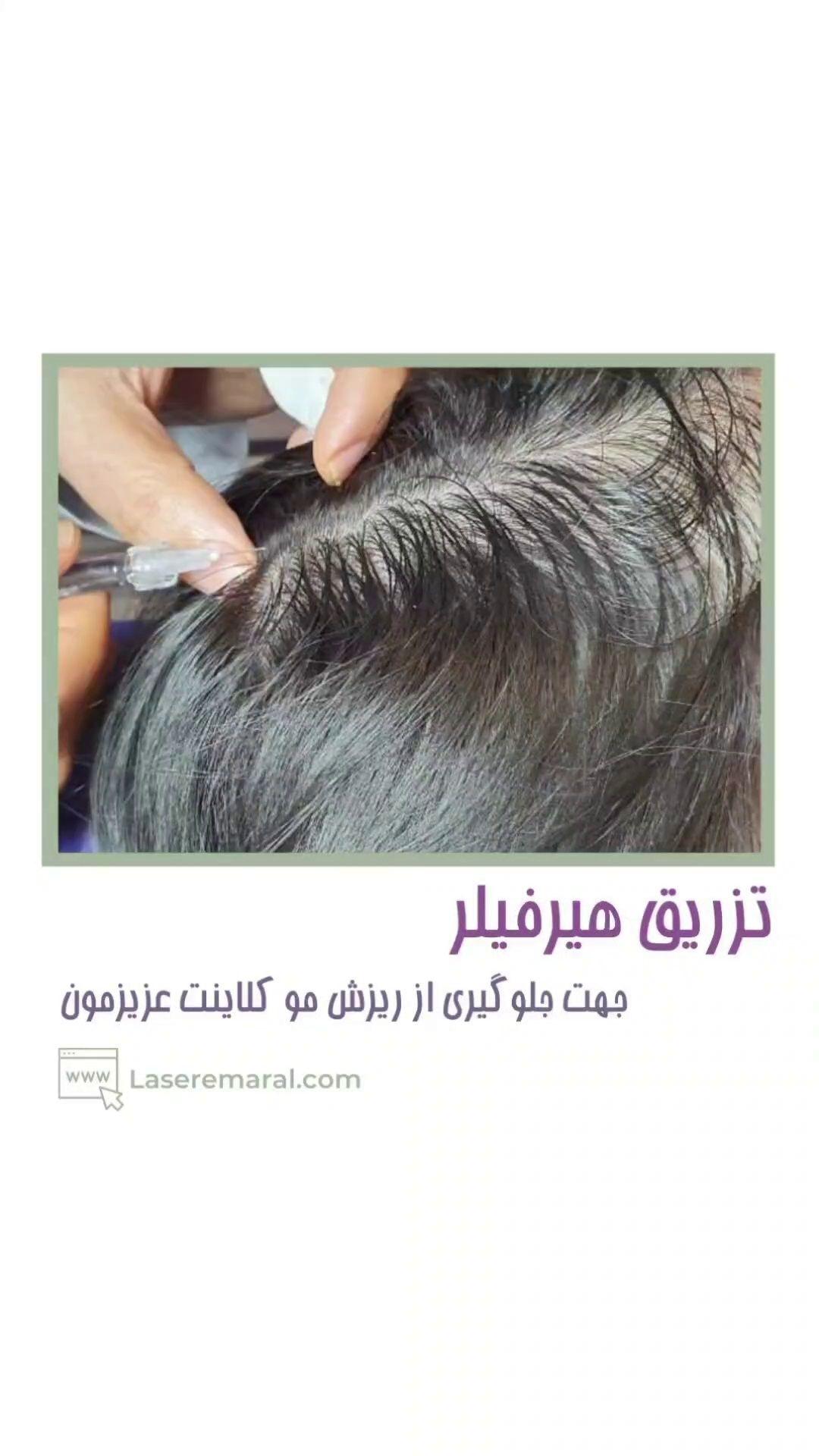مجموعه زیبایی و لیزر پردیس مارال/مطب دکتر مرضیه پوراکبری