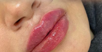 کلینیک پوست مو زیبایی ولاغری دکتر عقدائی