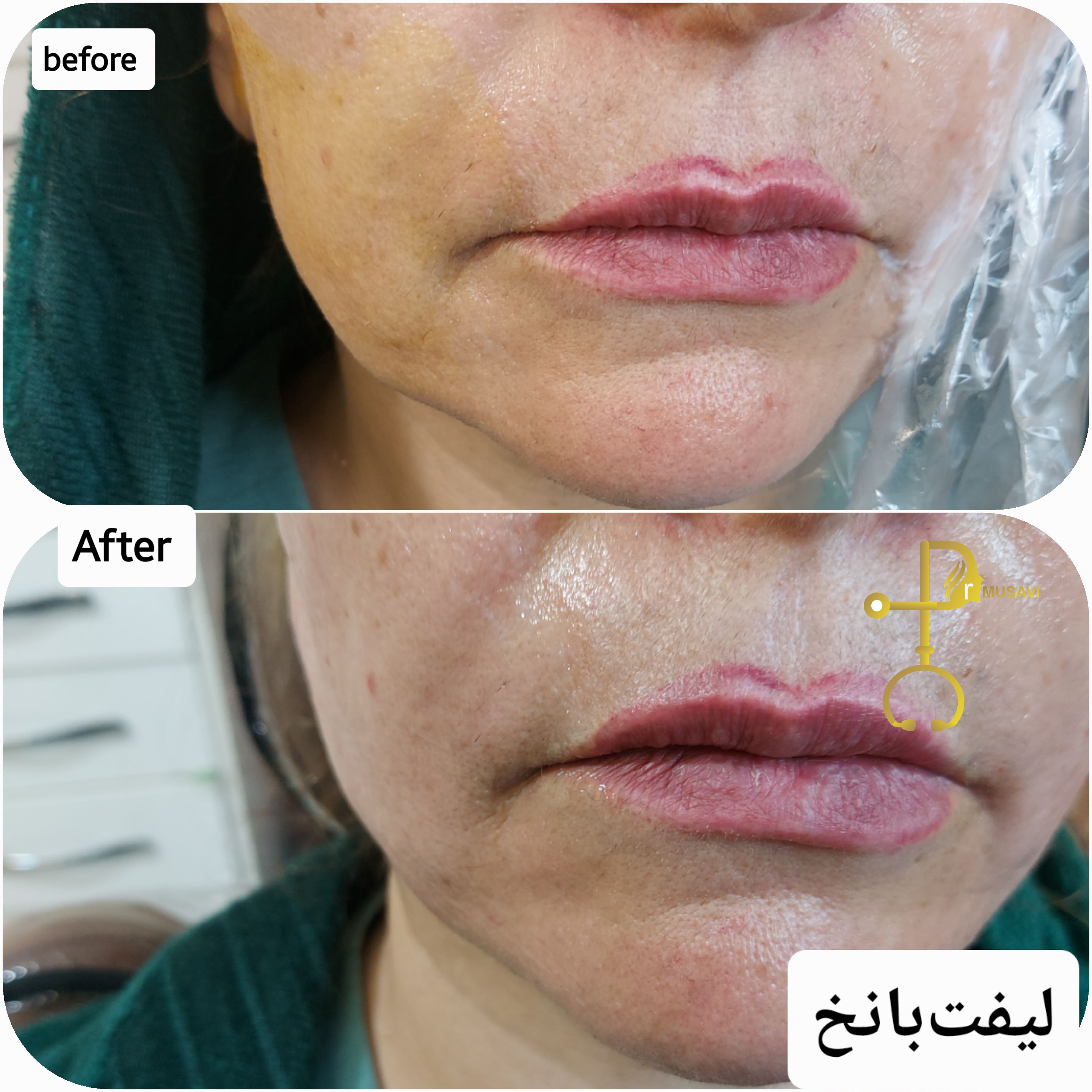 کلینیک زیبایی بوتاکس لیزر فیلر شجاعی