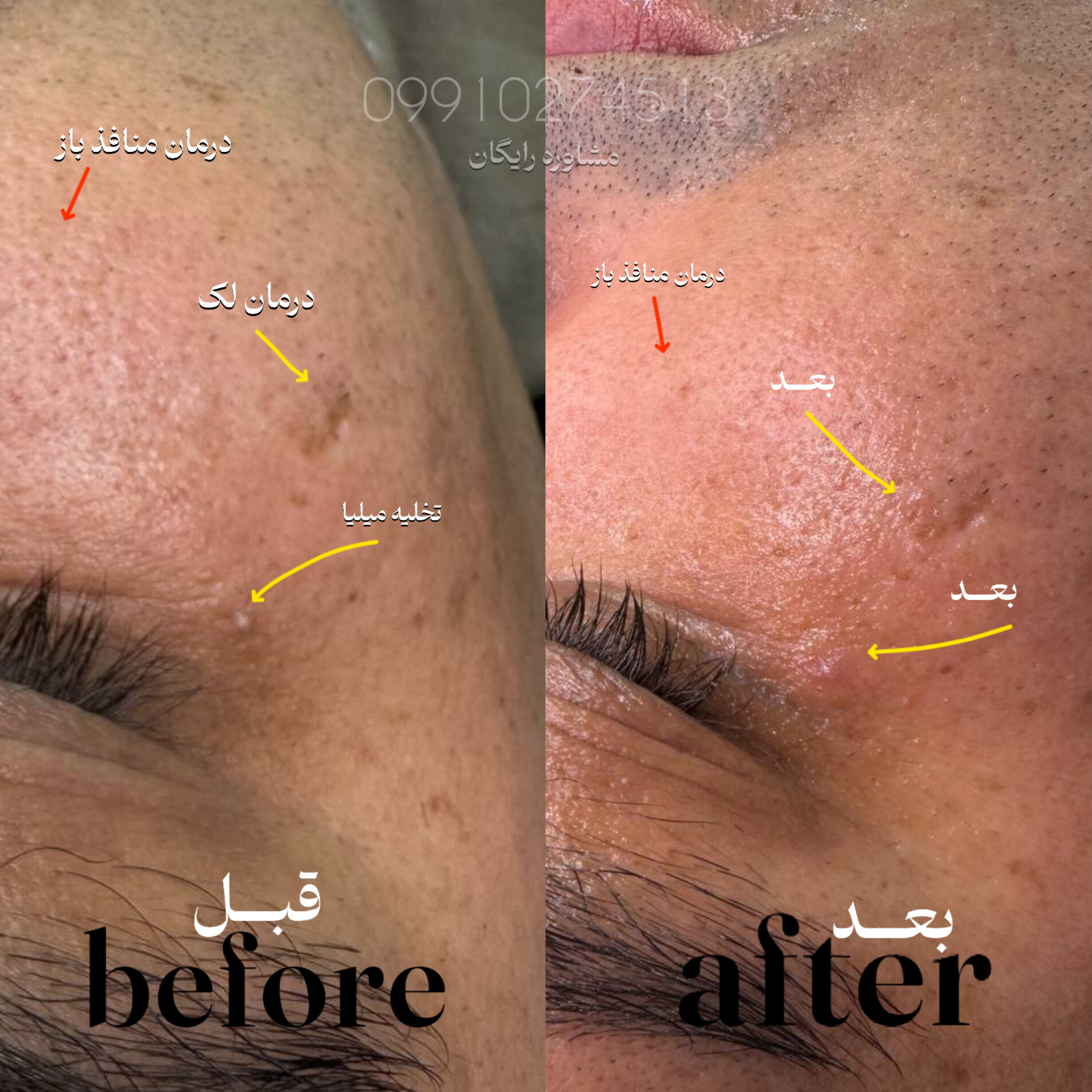 سالن تخصصی کوتاهی مو و فیشیال امیربارویی