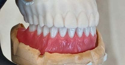 دندان مصنوعی