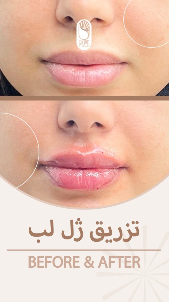 کلینیک زیبایی پارسی (کاشت ابرو کرج)