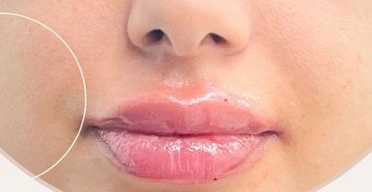 کلینیک زیبایی پارسی (کاشت ابرو کرج)