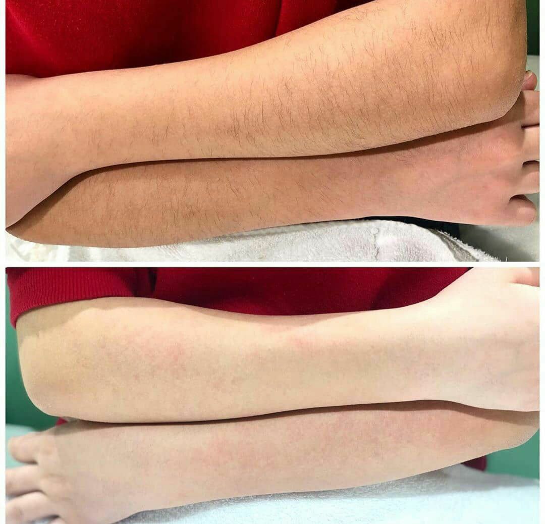 مرکز اپیلاسیون ماه شو