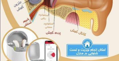 شنوایی سنجی و سمعک مهرنو