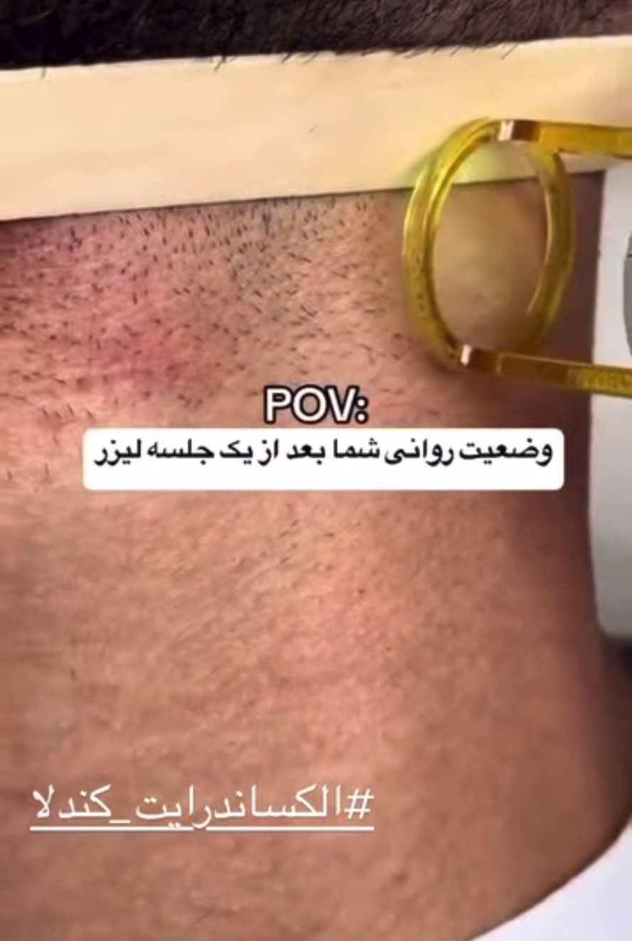 مرکز تخصصی لیزر الکساندرایت کندلا آرشیدا