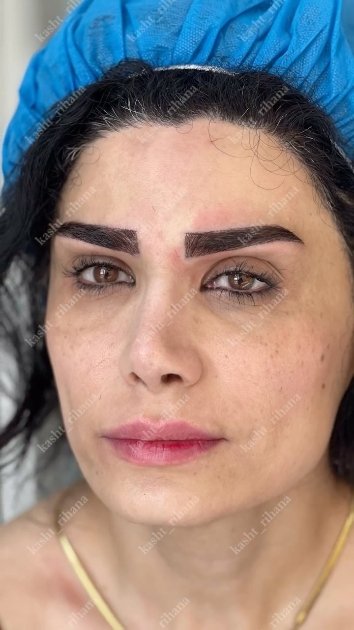 مرکز کاشت ابرو ریحانا در کرج