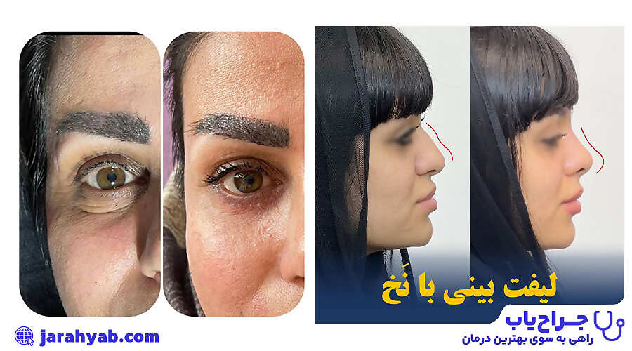 کلینیک زیبایی الین