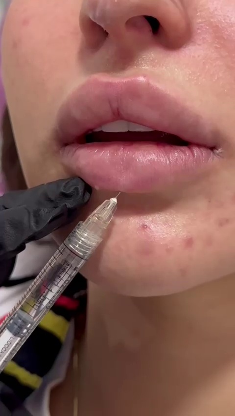 مرکز لیزر کلینیک زیبایی ماساژ گلاریس