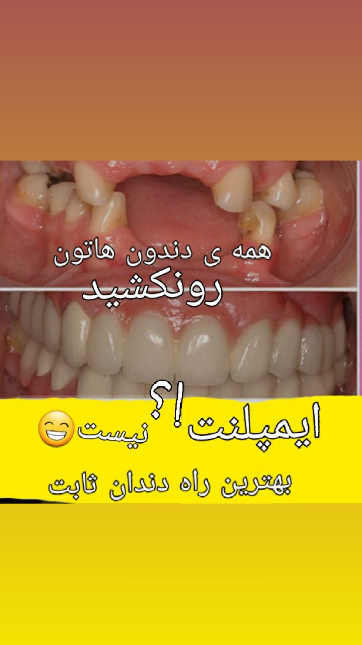 دندانسازی فرخی