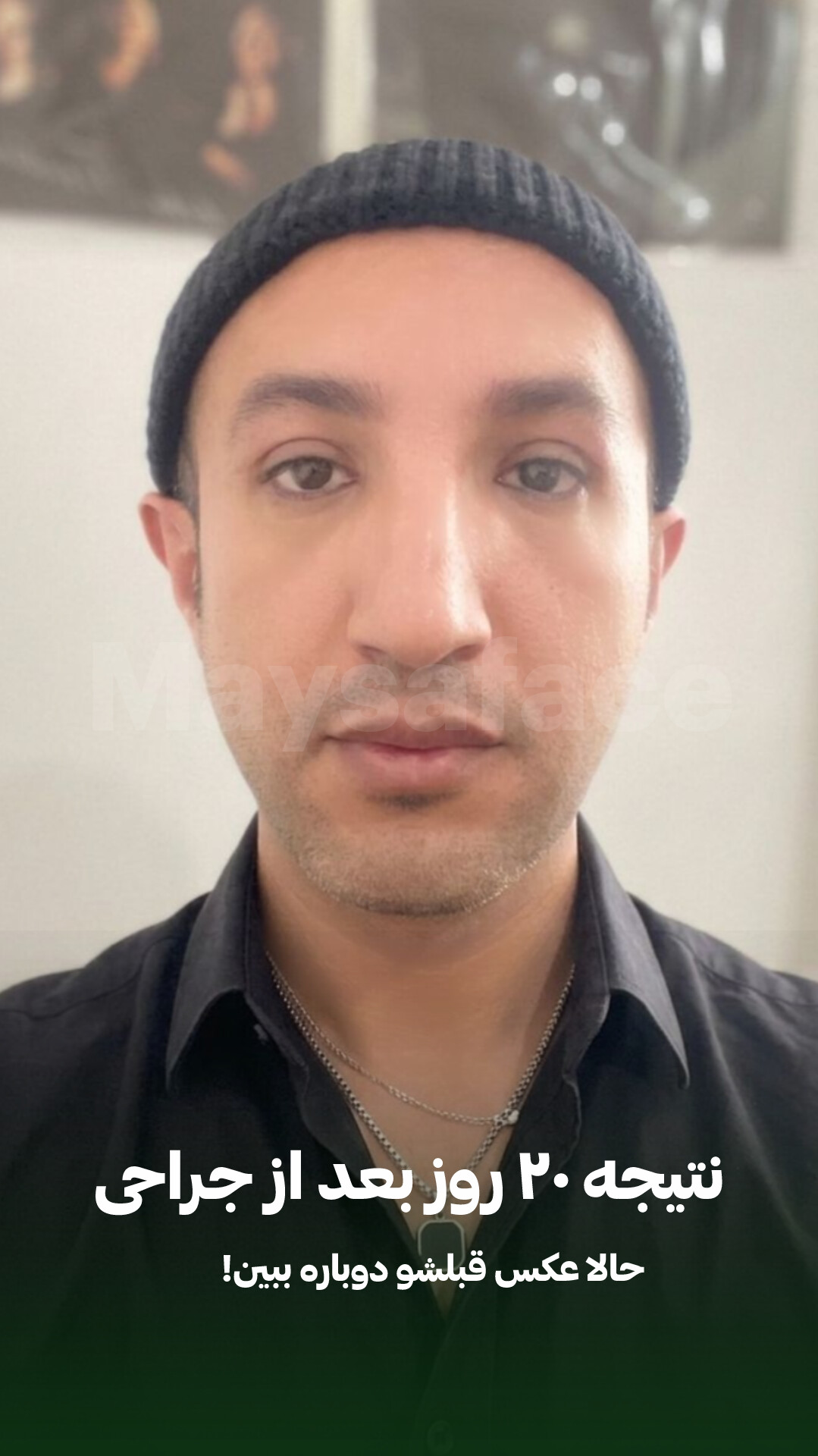 کلینیک زیبایی مایسا