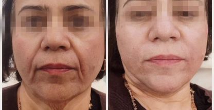 کلینیک زیبایی پوست مو لیزر