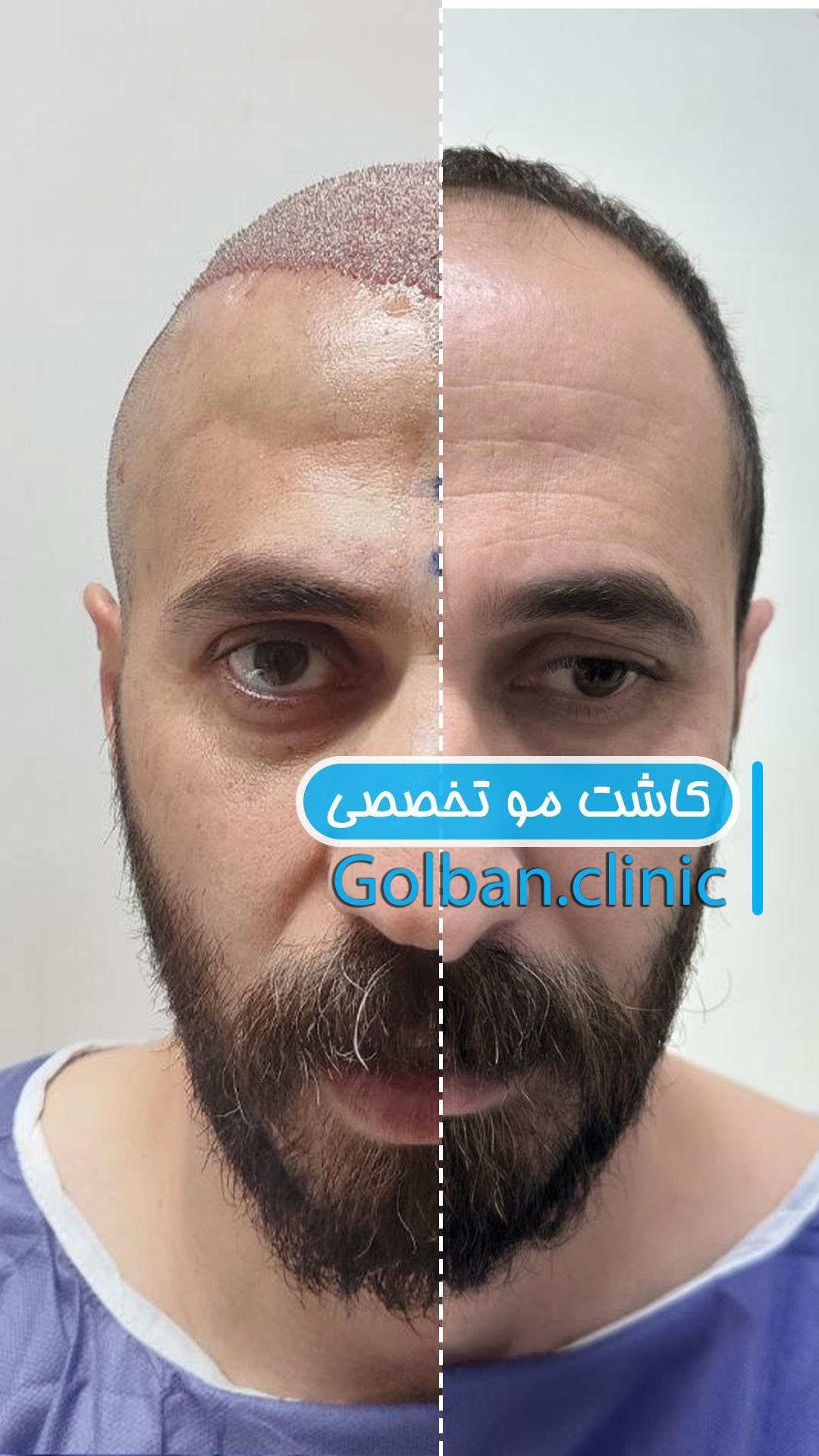 کلینیک زیبایی گلبان