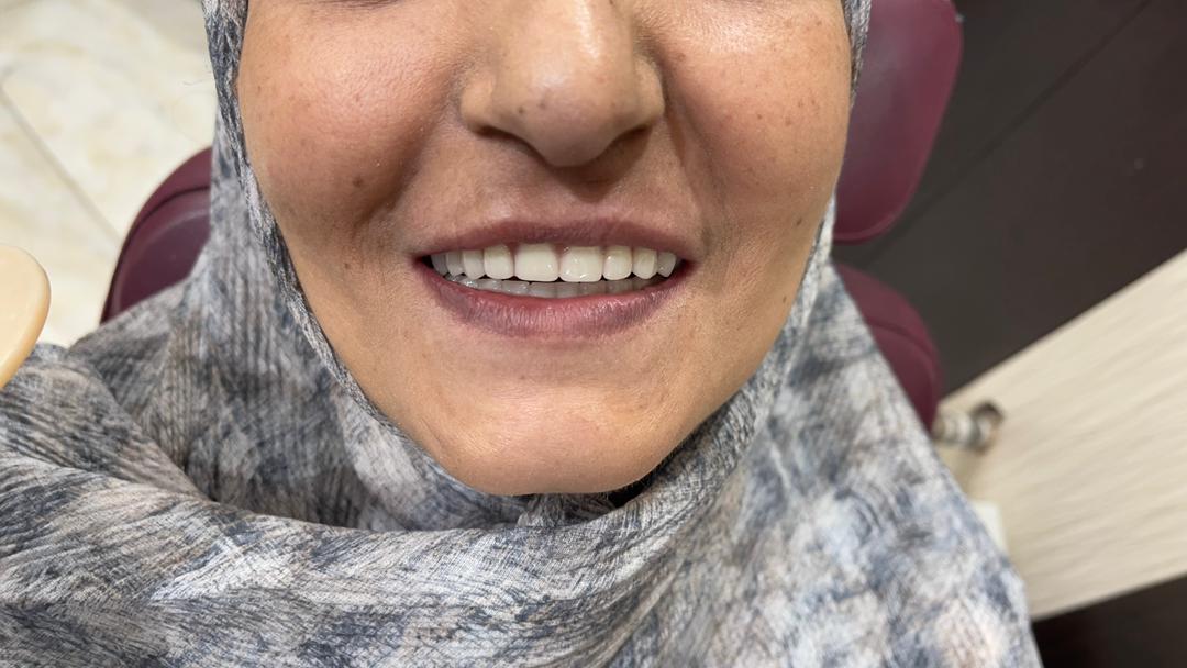 دندانسازی و لابراتوار محتشم