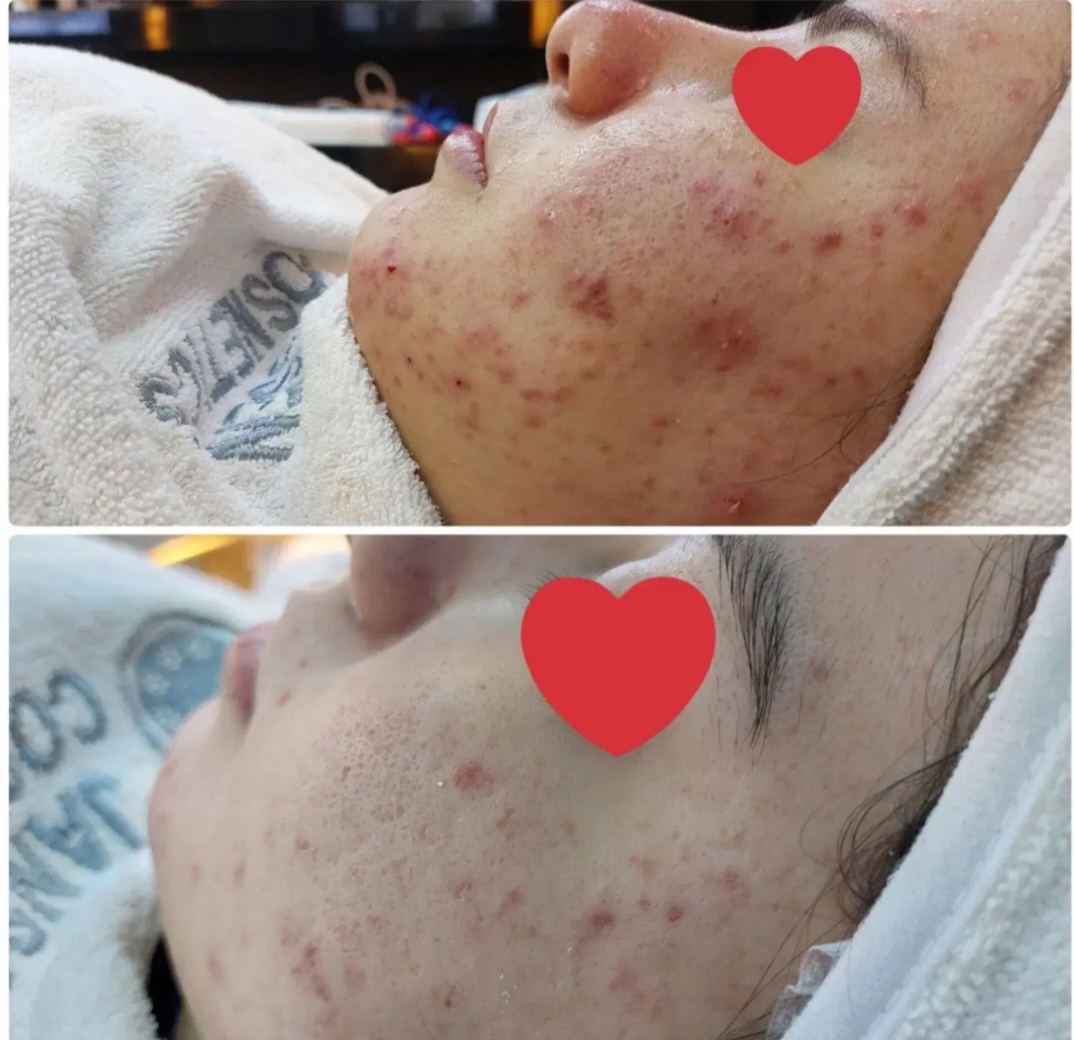 پاکسازی پوست وفیشال تخصصی فاطیما