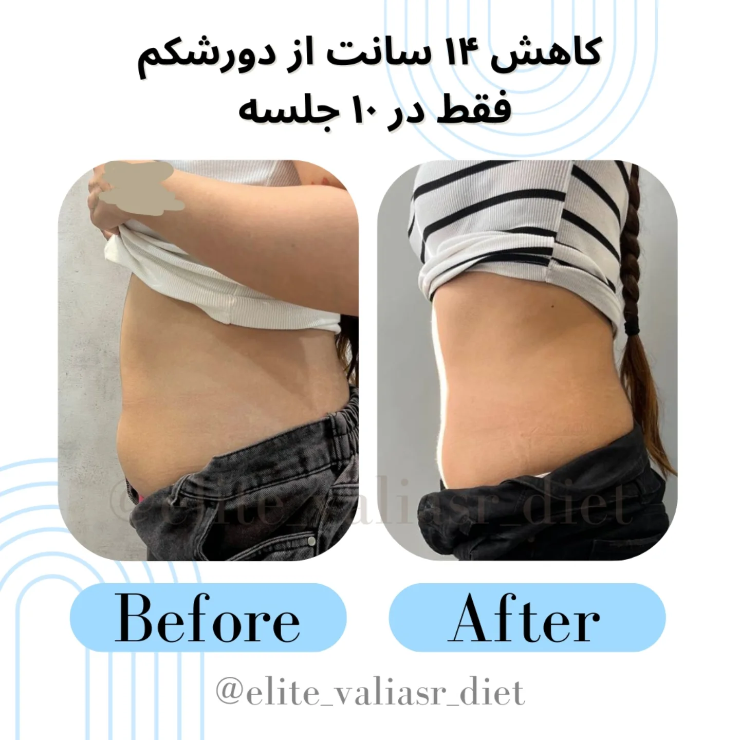 مرکز لاغری و تناسب اندام الیت ولیعصر