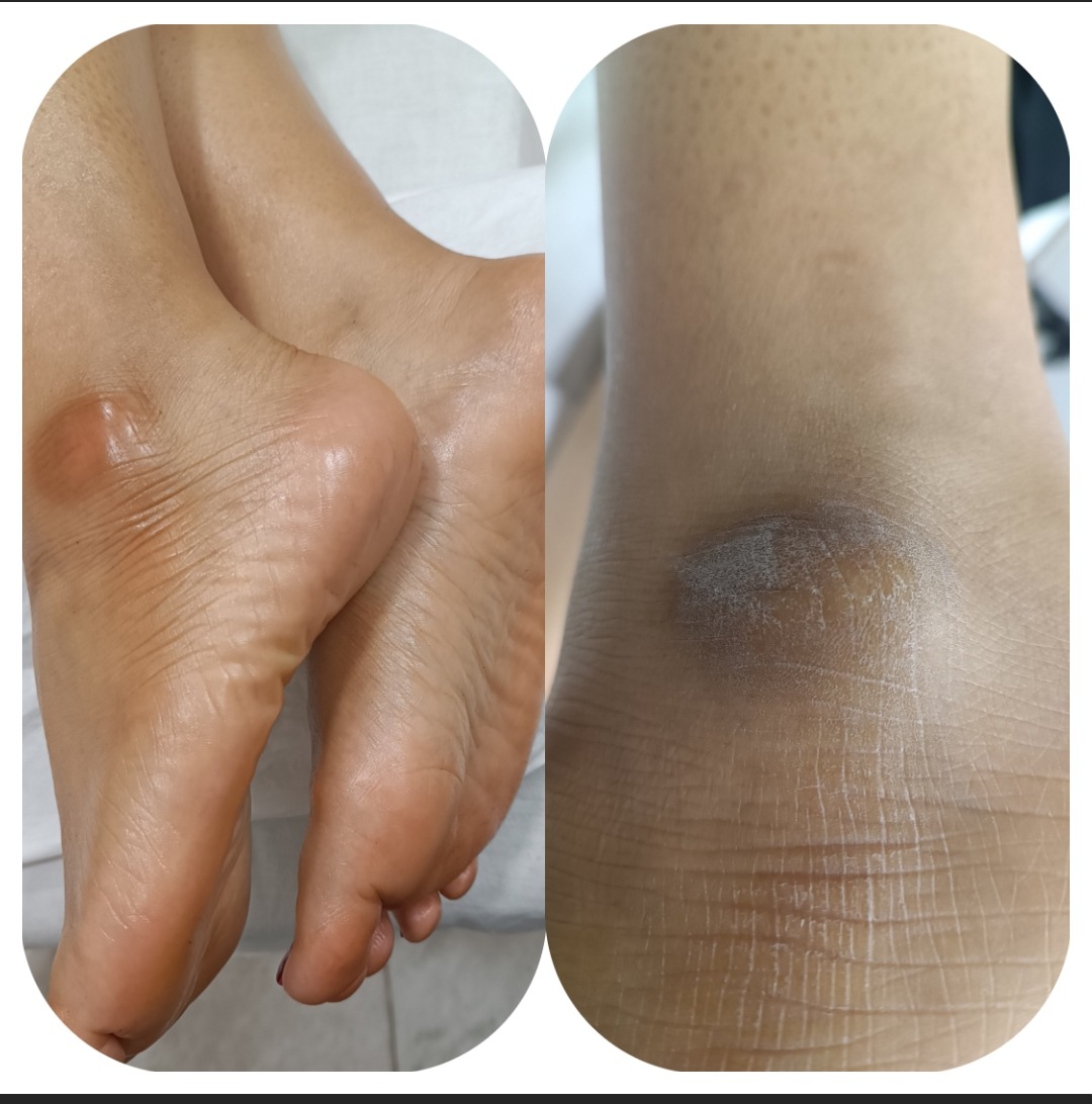 کفسابی و پدولوژی ناخن خانمها و آقایان