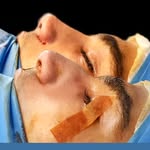 دکتر همایون منافی خسروشاهی، جراح بینی