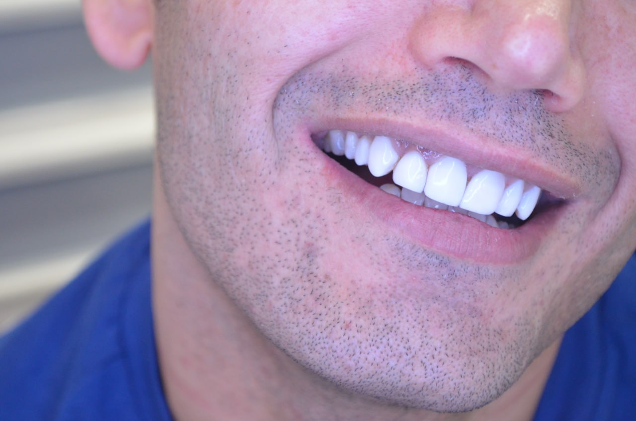 کلینیک دندانپزشکی ماه دنت (اقساطی)