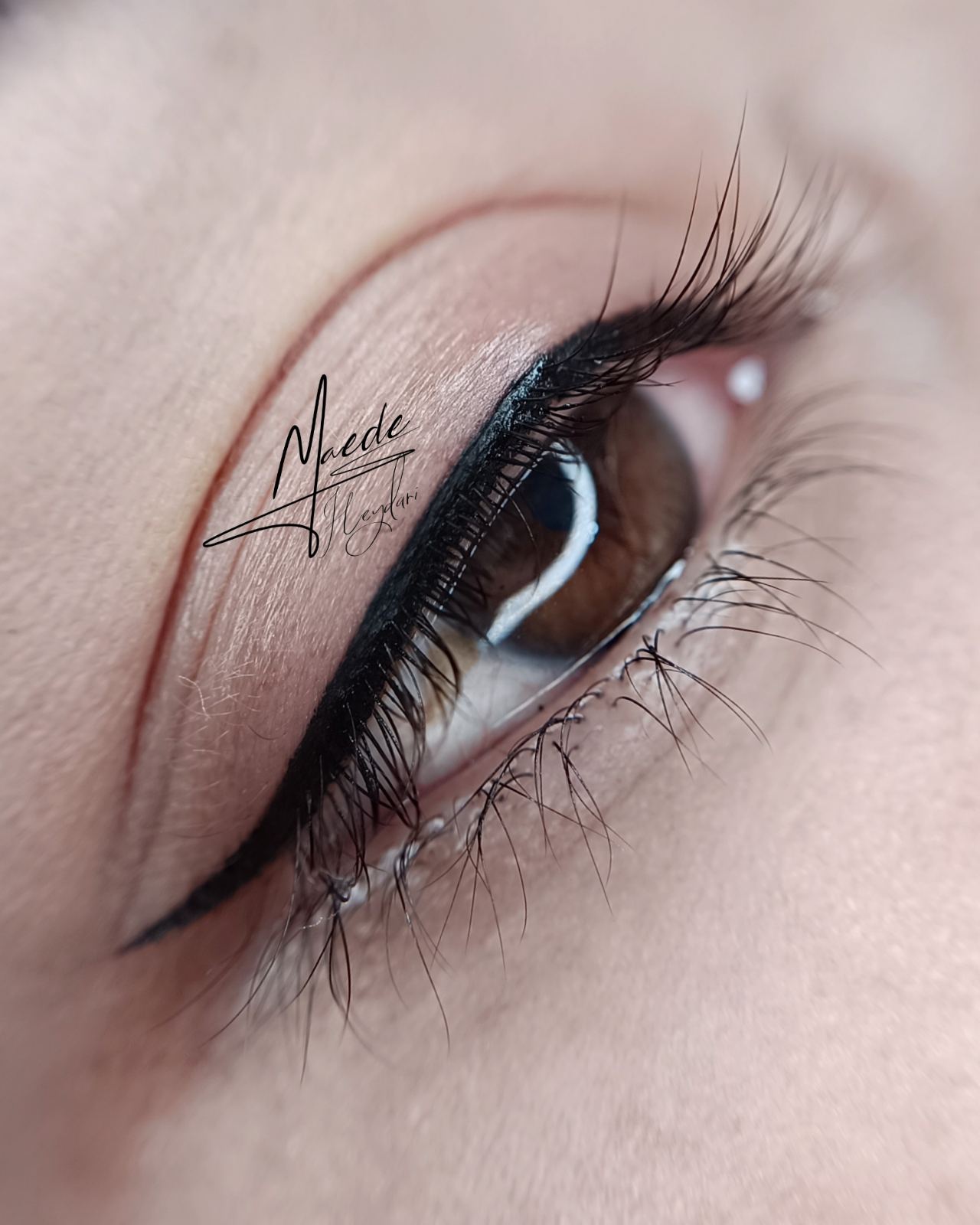 میکروبلیدینگ و شیدینگ و تتو مائده حیدری