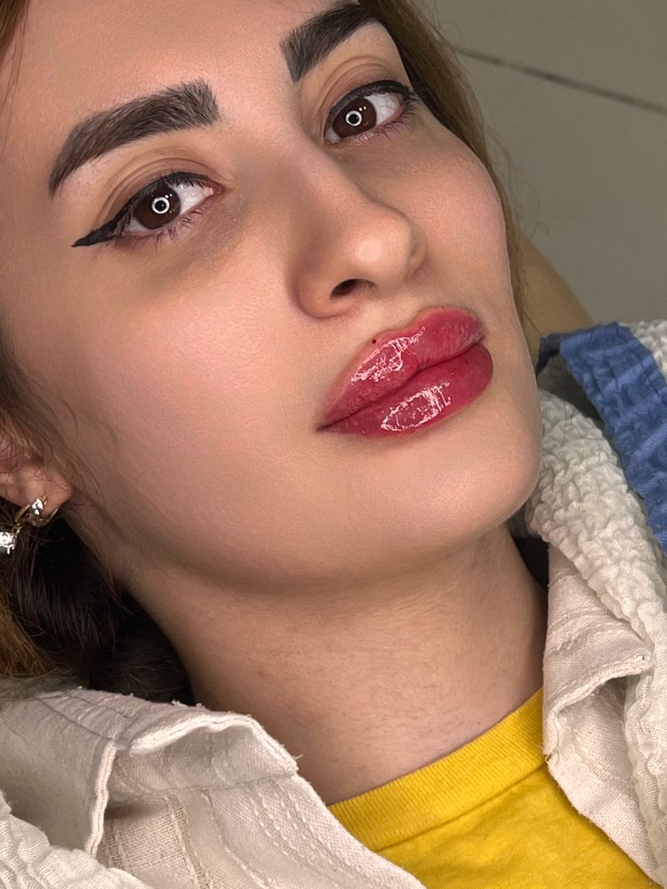 مرکز لیزر کلینیک پوست و مو فریسا