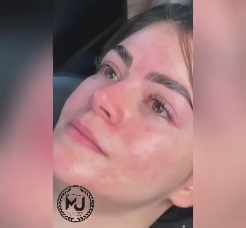 میکروبلیدینگ و تتو بدن سارا جعفری