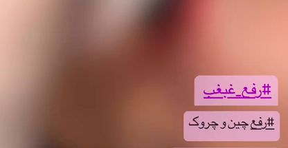 کلینیک لاغری و تناسب اندام شادی ابراهیمی