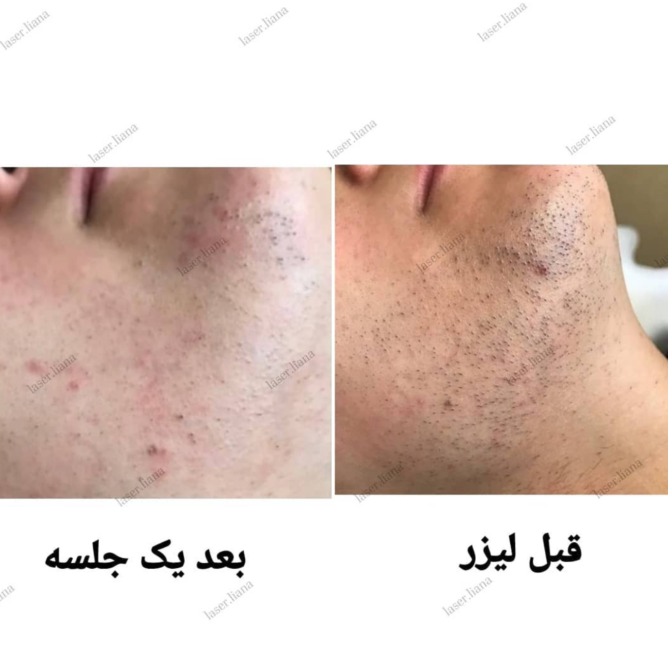 مرکز لیزر لیانا