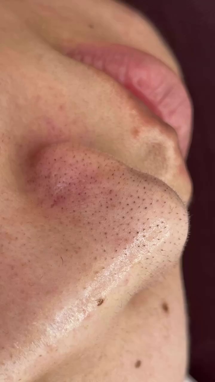 خدمات فیشال، جو انسازی و مشاوره پوست