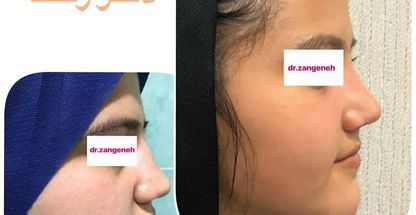 مطب جراح زیبایی دکتر حمیدرضا زنگنه