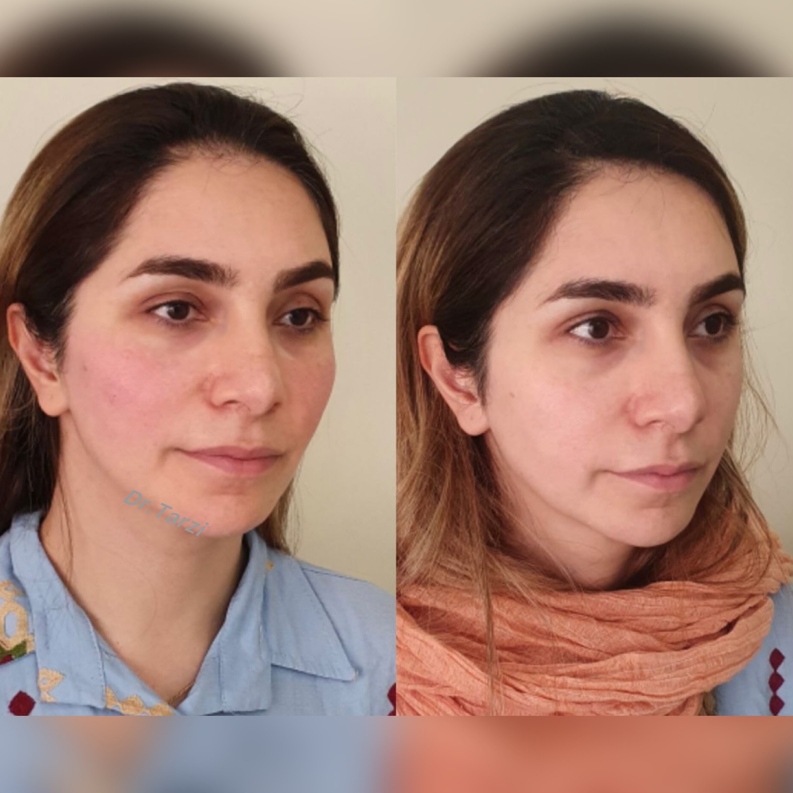 مرکز زیبایی دکتر فاطمه طرزی