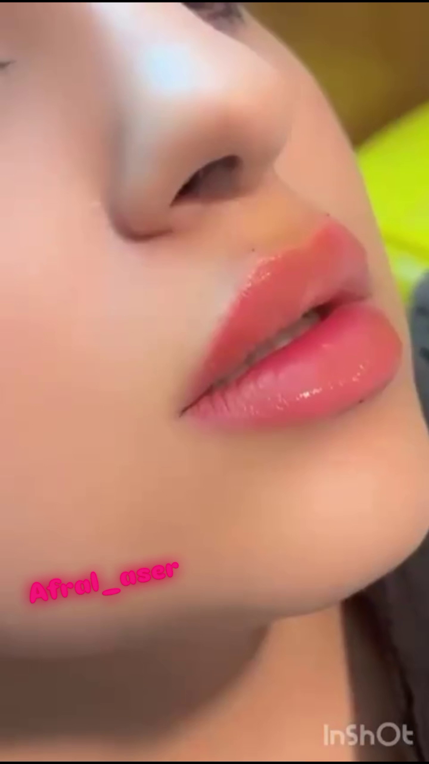 کلینیک لیزر و لاغری و زیبایی افرا لیزر