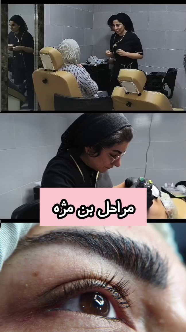 خدمات تخصصی ریمو و آرایش دائم