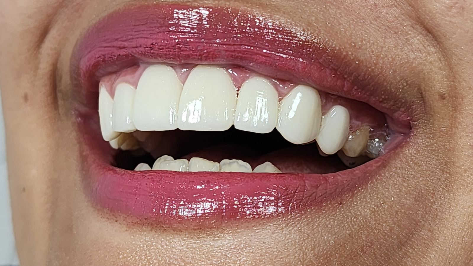 مطب دندانپزشکی دکتر فروتنی