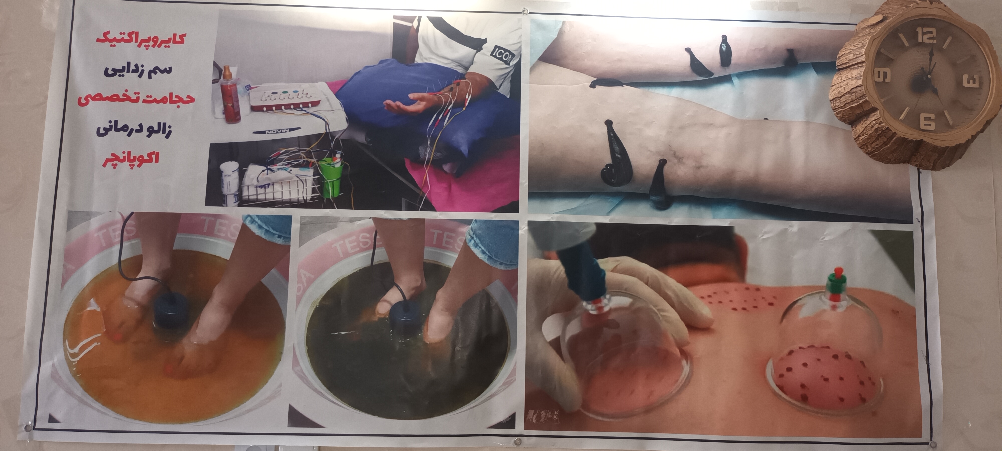 مرکز طب سوزنی و فزیوتراپی ماهور