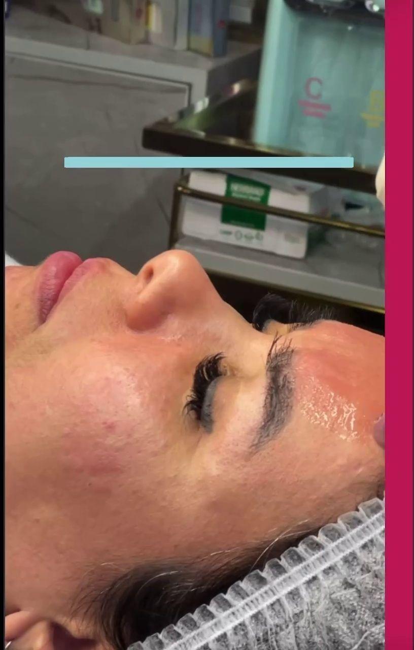 کلینیک پوست مو زیبایی و لیزر ونوس