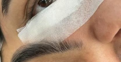 کاشت مژه "ما"